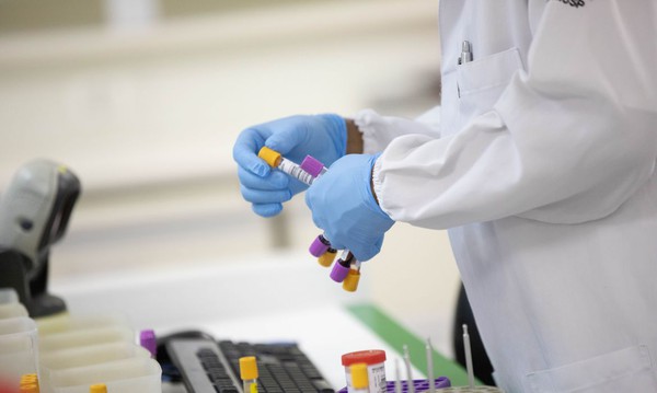 Capa Covid-19: em uma semana, casos caem 30% e mortes, 13%
